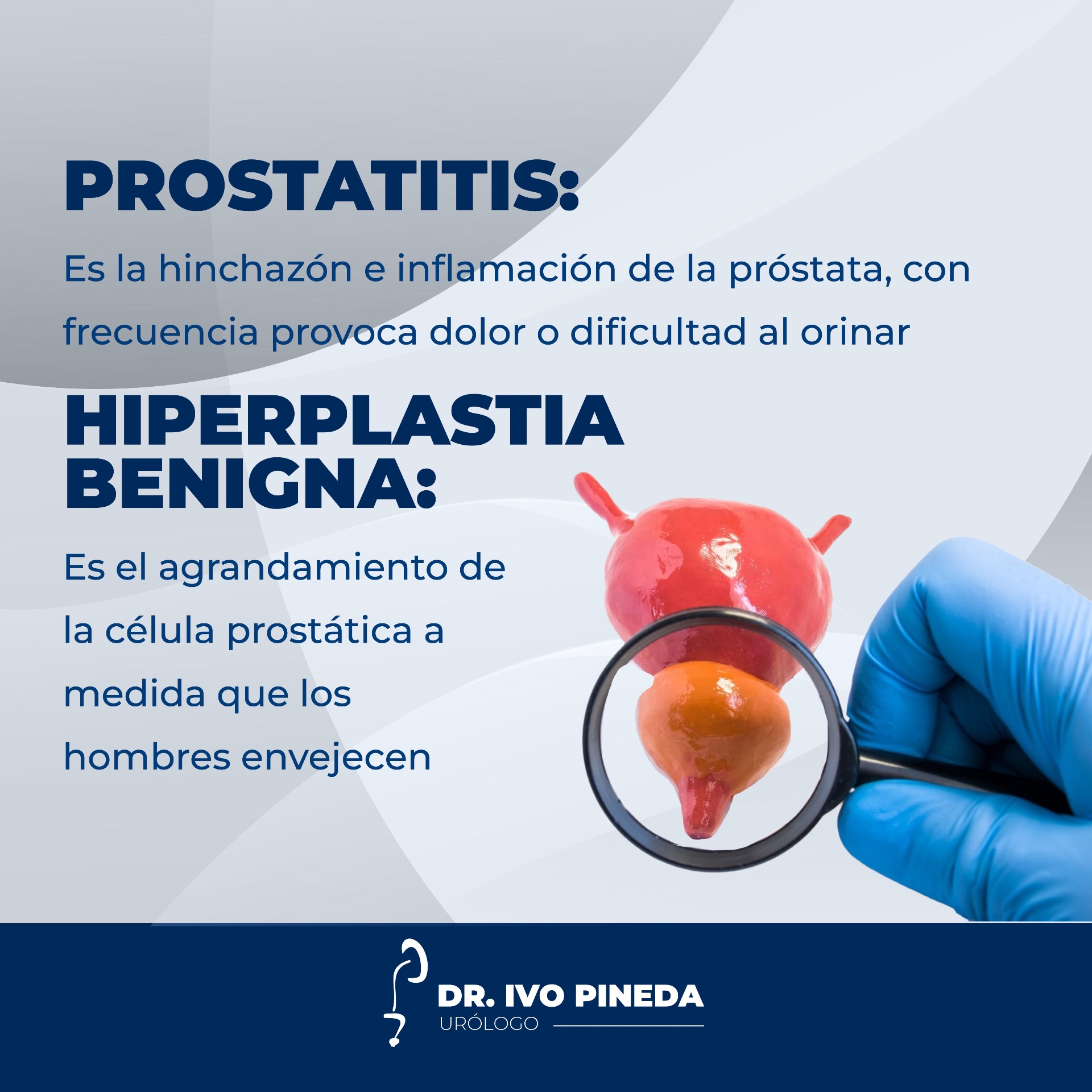 Definiciones de prostatitis e hiperplasia benigna